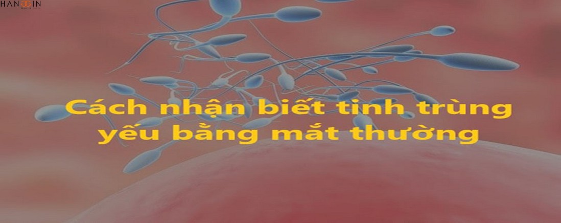 Trắng, vàng cùng nhiều màu của tinh trùng biểu hiện trạng thái sức khỏe gì?