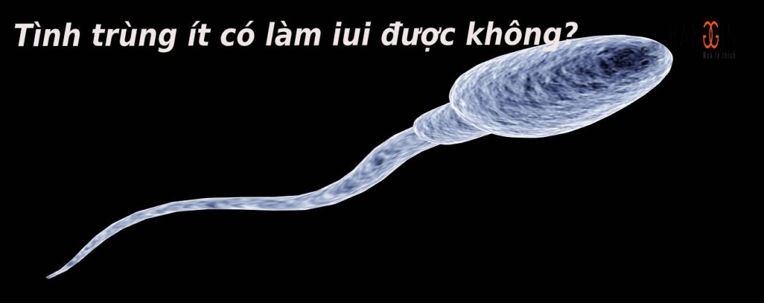 Nam giới tinh trùng loãng, ít có thể làm IUI được không?