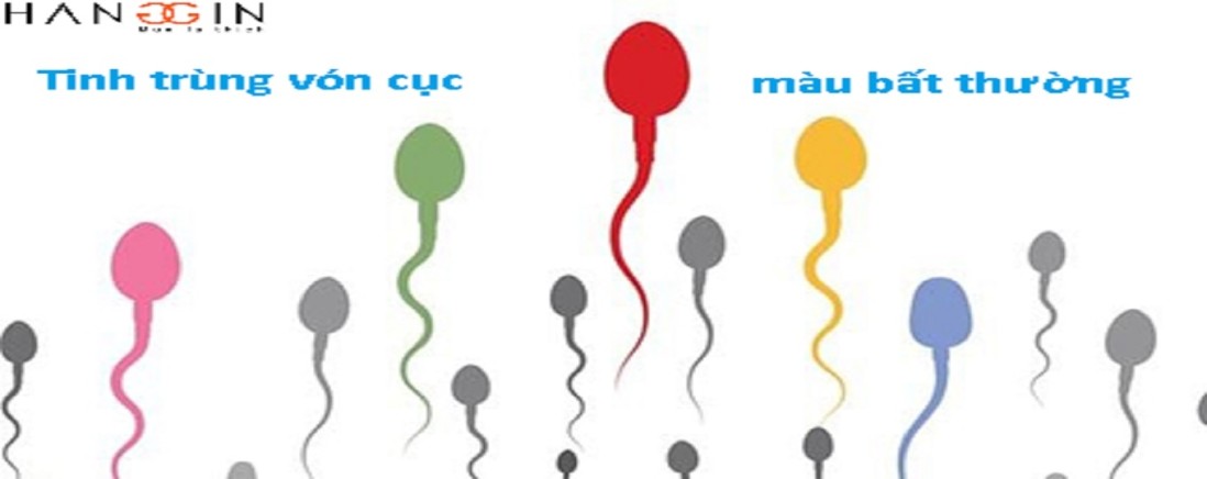 Tinh trùng vón cục có màu vàng, trắng, nâu nói lên điều gì?