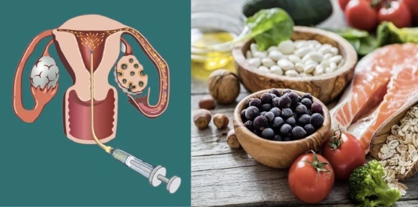 Phụ nữ sau khi thụ tinh nhân tạo bơm tinh trùng cần ăn gì? kiêng gì?