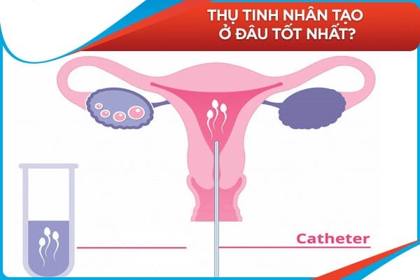 Top địa chỉ thụ tinh nhân tạo hiệu quả nhất tại Hà Nội tphcm