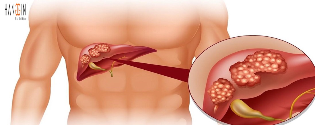 Cung cấp thông tin công dụng thuốc bổ gan Zirkulin leber vital hàng đức