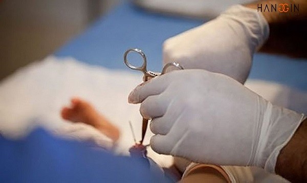 Xuất tinh sớm sau khi cắt bao quy đầu có phải là vấn đề đáng lo?