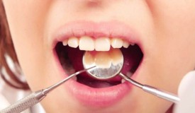 Giải đáp: bệnh tiểu đường nhổ răng được không? Có nguy hiểm không?